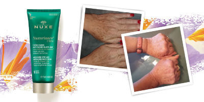 Nuxuriance® Ultra krema za roke proti pigmentnim madežem